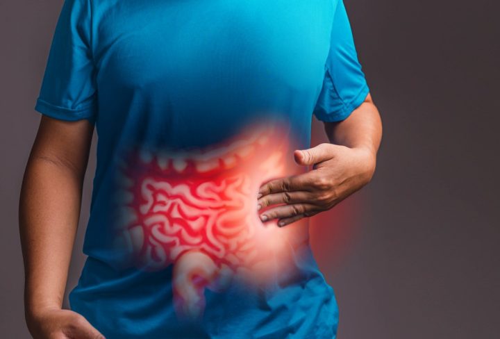 Colon Surgery 2